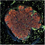 Tessuto di fegato umano impiantato in un topo