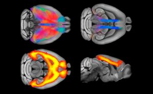 fMRI to study serotonin physiology