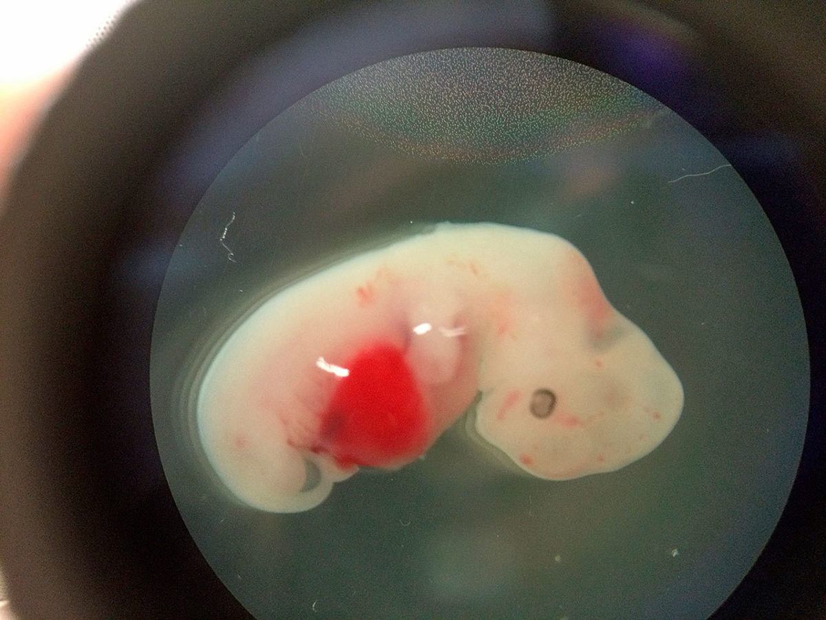 Embrione di pecora