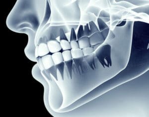 Dental regeneration