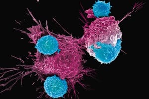 car-t terapia genica cura al cancro