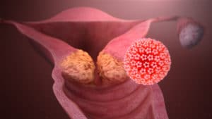 L'epigenetica e il cancro da HPV