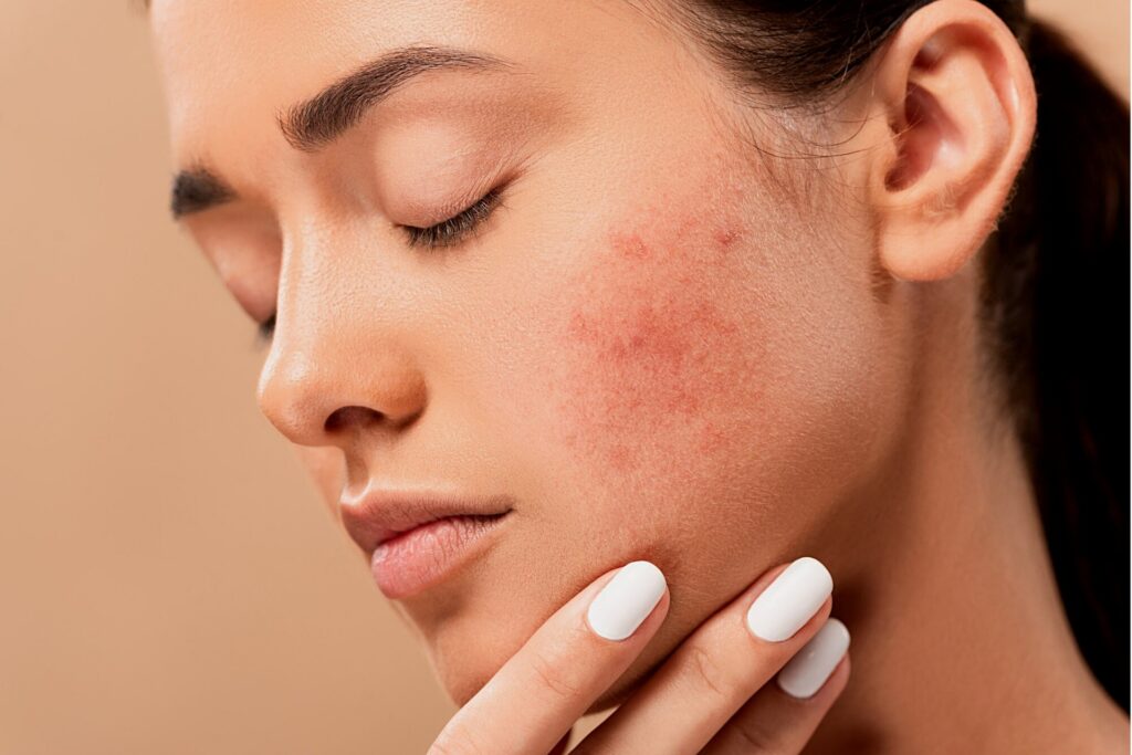 Visita dermatologica: come e quando va fatta